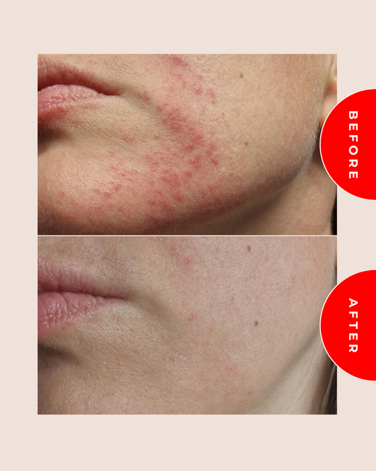 SOS修護凝膠 Dermo-repair Gel