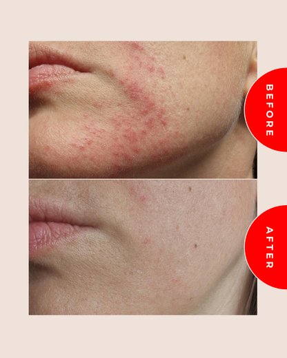 SOS修護凝膠 Dermo-repair Gel