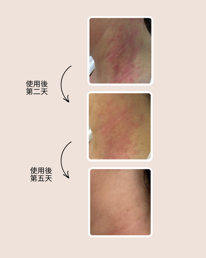 SOS修護凝膠 Dermo-repair Gel