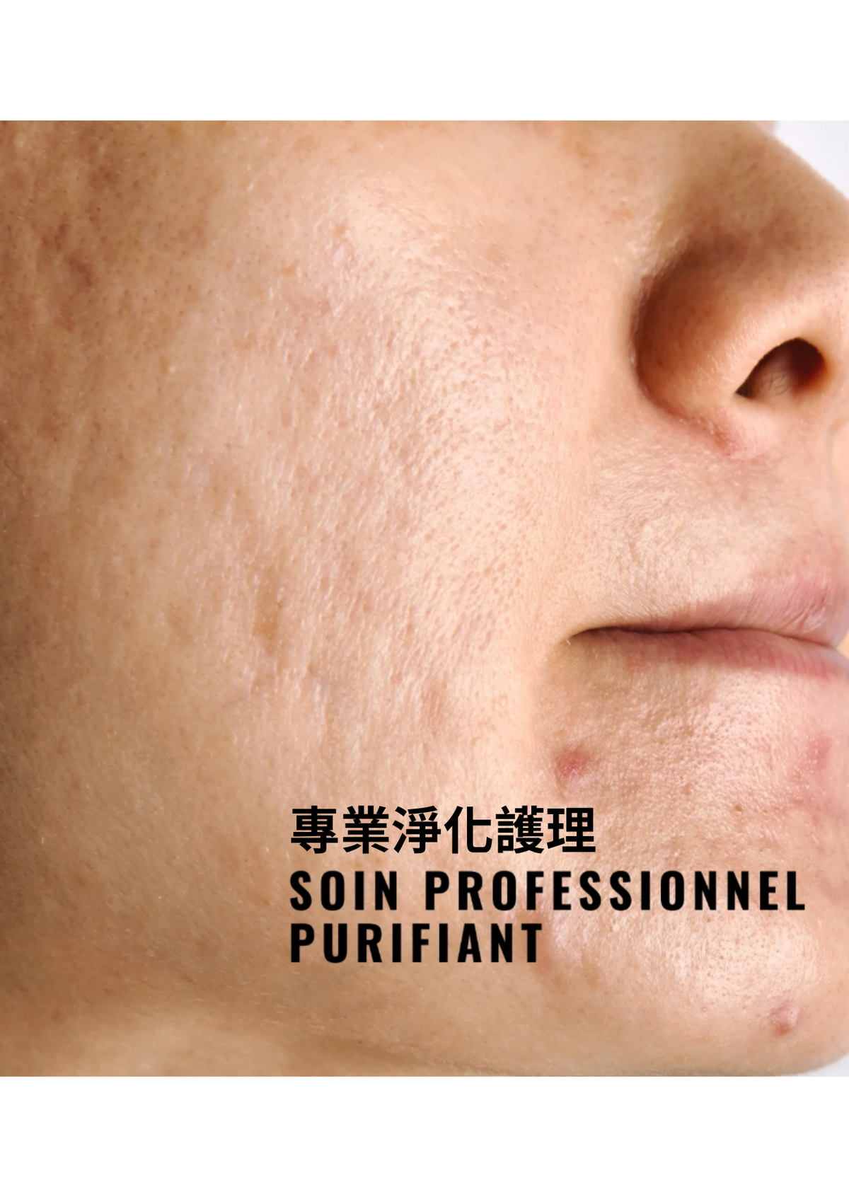 [PRO] 純極淨剝落式面膜  Purifying Peel-Off Mask