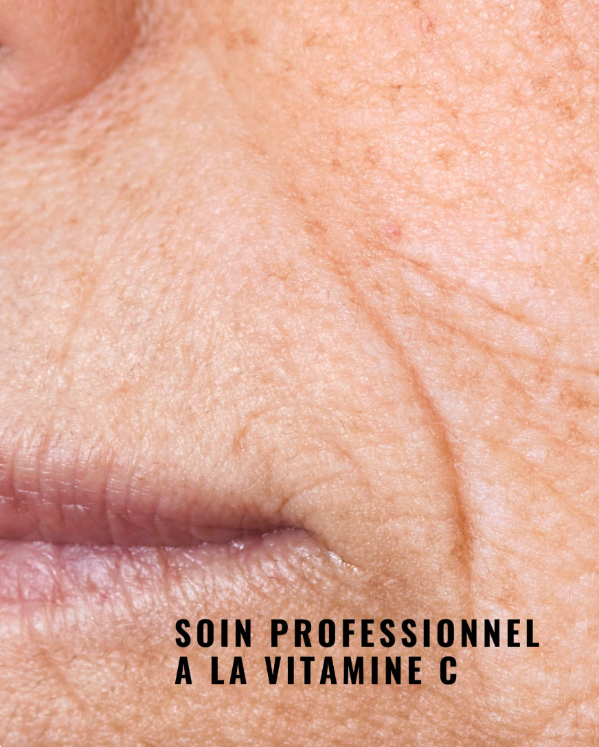 [PRO] 活氧賦活剝落式面膜 Sparkling Peel-Off Mask