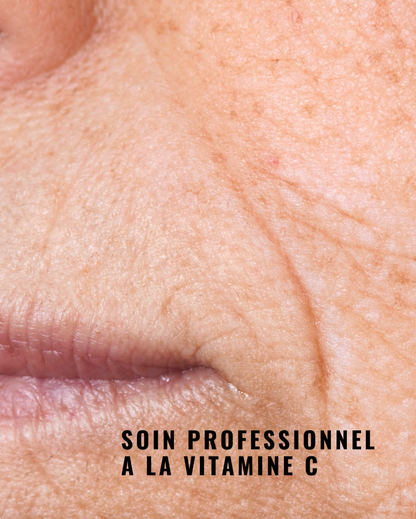 [PRO] 活氧賦活剝落式面膜 Sparkling Peel-Off Mask